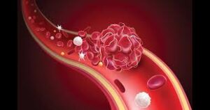 Ginkgo Biloba drug interactions